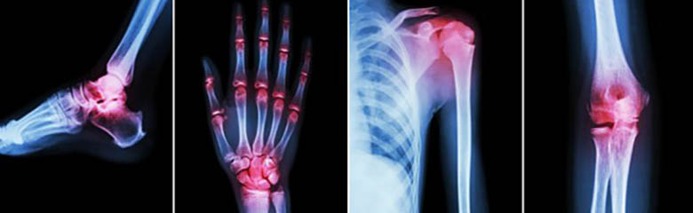 Pain Services - Pain Clinic - Top Image