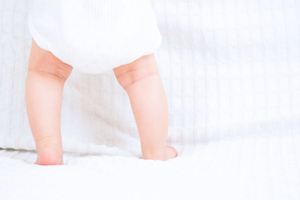 Bow-legs (Genu Varum) image Bow-legs (Genu Varum) image