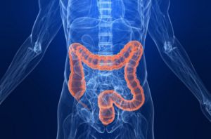 cancer colon nhs