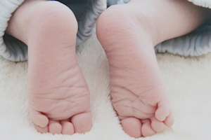 Curly toes image Curly toes image