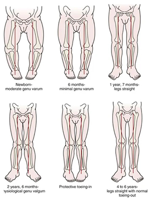 Foot and leg shape graphic Foot and leg shape graphic