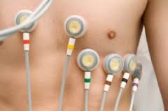 24-hour ECG recording 24-hour ECG recording