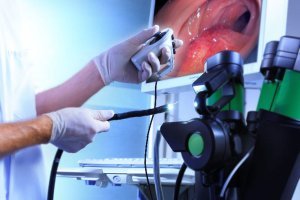 Endoscopy Service Endoscopy Service