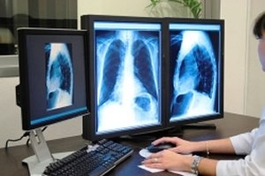 Imaging Imaging