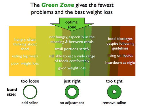 Bariatric Surgery Weight Loss Chart