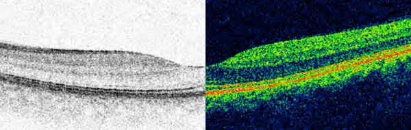 Medical photography - clinical photography image Medical photography - clinical photography image