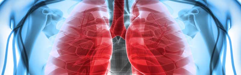 CHP - Respiratory Medicine - Top Image CHP - Respiratory Medicine - Top Image