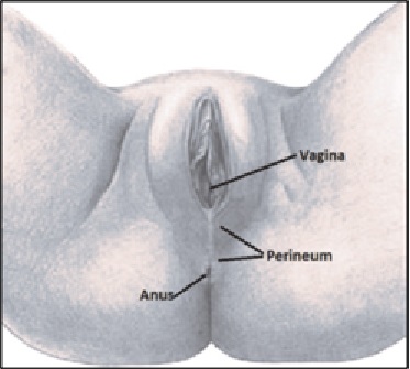 Picture - external female pelvic anatomy
