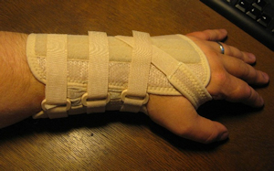 Hand Splint Hand Splint
