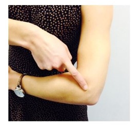 Picture of woman pointing at her elbow