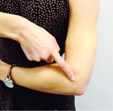 Image of a woman pointing to her Occult proximal radius fracture
