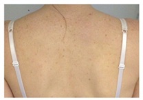 Posture back