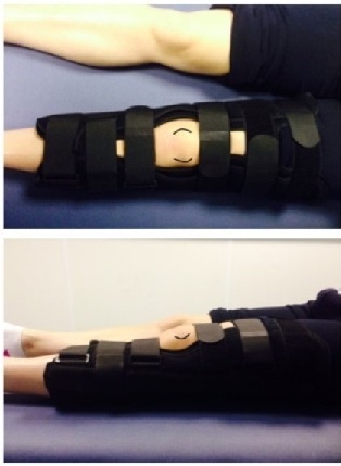 Knee brace image