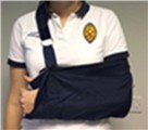 Photograph of person with left arm in a sling