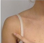 Photo of shoulder