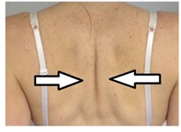 Back squeeze
