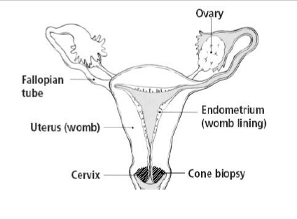 Image of female reproductive organs