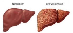 Livers Image Livers Image