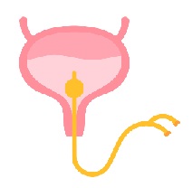 A uterus with yellow catheter tube