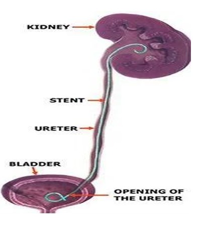 Image of kidney and bladder