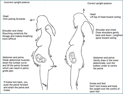 Diagram - incorrect and incorrect posture