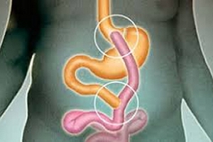 Digestive System graphic Digestive System graphic